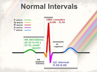 Normal Intervals
 