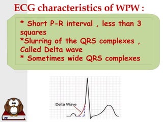 ECG characteristics of WPW :
* Short P-R interval , less than 3
squares
*Slurring of the QRS complexes ,
Called Delta wave
* Sometimes wide QRS complexes
 
