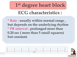 1st degree heart block
ECG characteristics :
* Rate : usually within normal range ,
but depends on the underlying rhythm
* PR interval : prolonged more than
0.20 sec ( more than 5 small squares)
but constant.
 