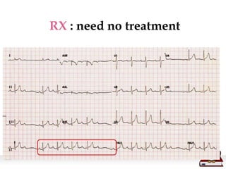 RX : need no treatment
 