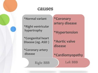 Right BBB Left BBB
*Normal variant
*Right ventricular
hypertrophy
*Congenital heart
Disease (eg. ASD )
*Coronary artery
disease
*Coronary
artery disease
*Hypertension
*Aortic valve
disease
*Cardiomyopathy
causes
 