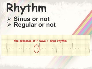 Rhythm
 Sinus or not
 Regular or not
 