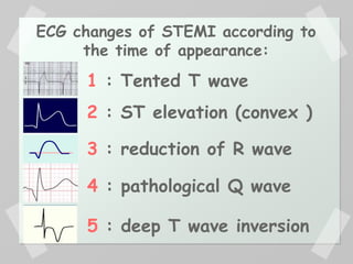 ECG changes of STEMI according to
the time of appearance:
1 : Tented T wave
2 : ST elevation (convex )
3 : reduction of R wave
4 : pathological Q wave
5 : deep T wave inversion
 