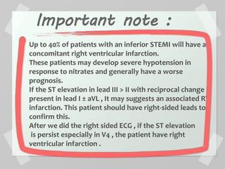 Important note :
Up to 40% of patients with an inferior STEMI will have a
concomitant right ventricular infarction.
These patients may develop severe hypotension in
response to nitrates and generally have a worse
prognosis.
If the ST elevation in lead III > II with reciprocal change
present in lead I ± aVL , It may suggests an associated RV
infarction. This patient should have right-sided leads to
confirm this.
After we did the right sided ECG , if the ST elevation
is persist especially in V4 , the patient have right
ventricular infarction .
 