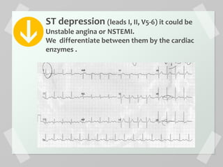 ST depression (leads I, II, V5-6) it could be
Unstable angina or NSTEMI.
We differentiate between them by the cardiac
enzymes .
 