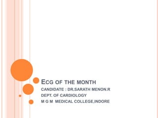 ECG OF THE MONTH
CANDIDATE : DR.SARATH MENON.R
DEPT. OF CARDIOLOGY
M G M MEDICAL COLLEGE,INDORE
 