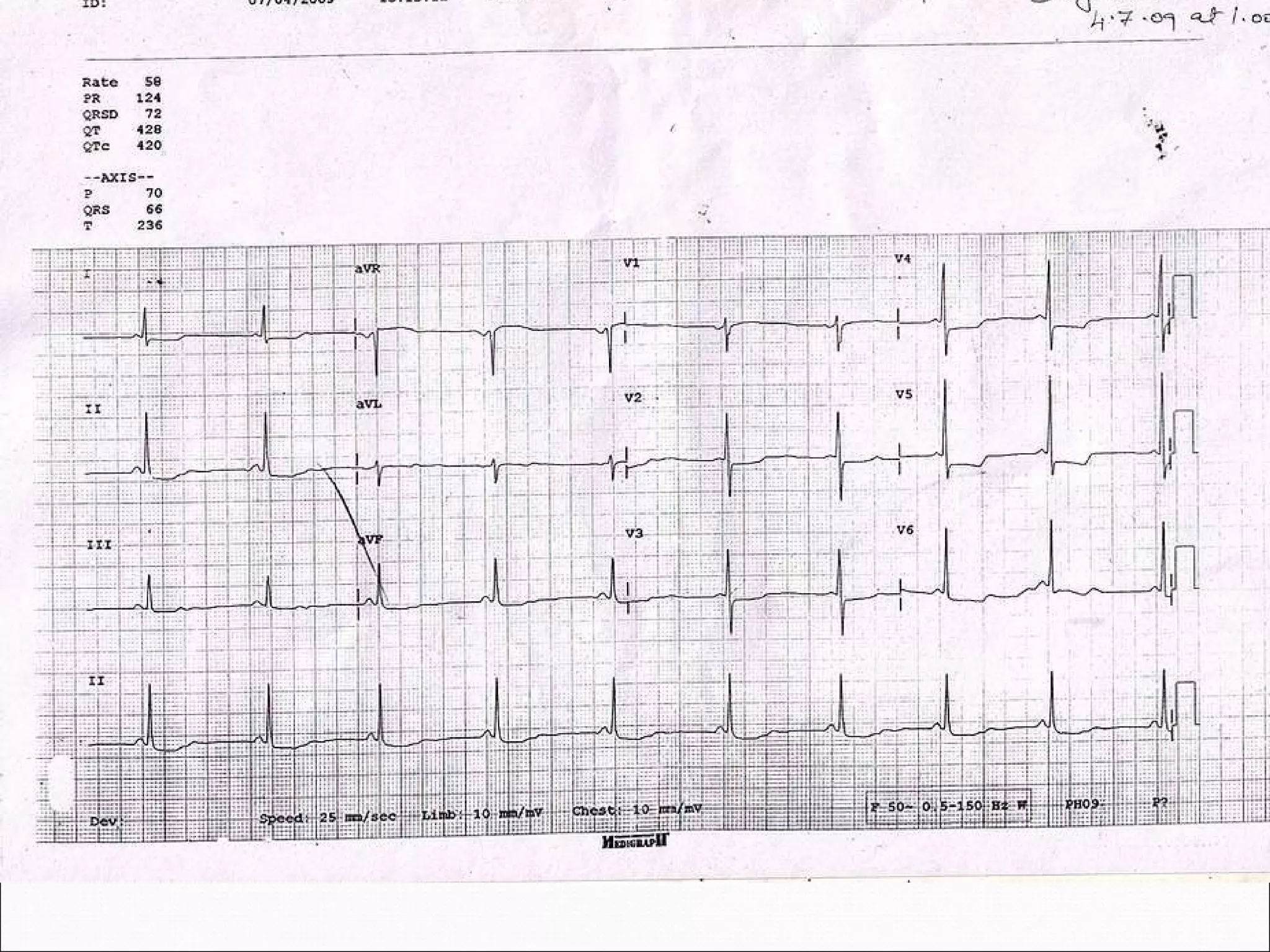 Christian Wolff (philosopher) visual data 8