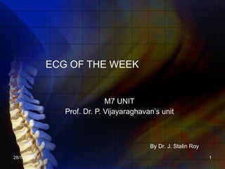 ECG OF THE WEEK M7 UNIT  Prof. Dr. P. Vijayaraghavan’s unit By Dr. J. Stalin Roy 