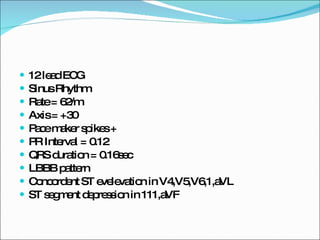 12 lead ECG Sinus Rhythm Rate = 62/m Axis = +30 Pace maker spikes + PR Interval = 0.12 QRS duration = 0.16sec LBBB pattern Concordent ST evelevation in V4,V5,V6,1,aVL ST segment depression in 111,aVF 