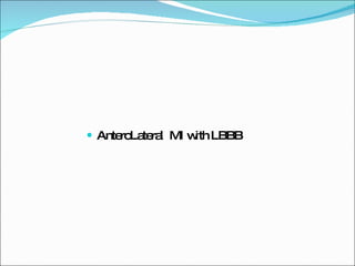AnteroLateral  MI with LBBB 