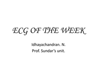 ECG OF THE WEEK Idhayachandran. N. Prof. Sundar’s unit. 
