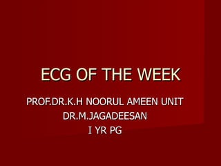 ECG OF THE WEEK PROF.DR.K.H NOORUL AMEEN UNIT DR.M.JAGADEESAN I YR PG 