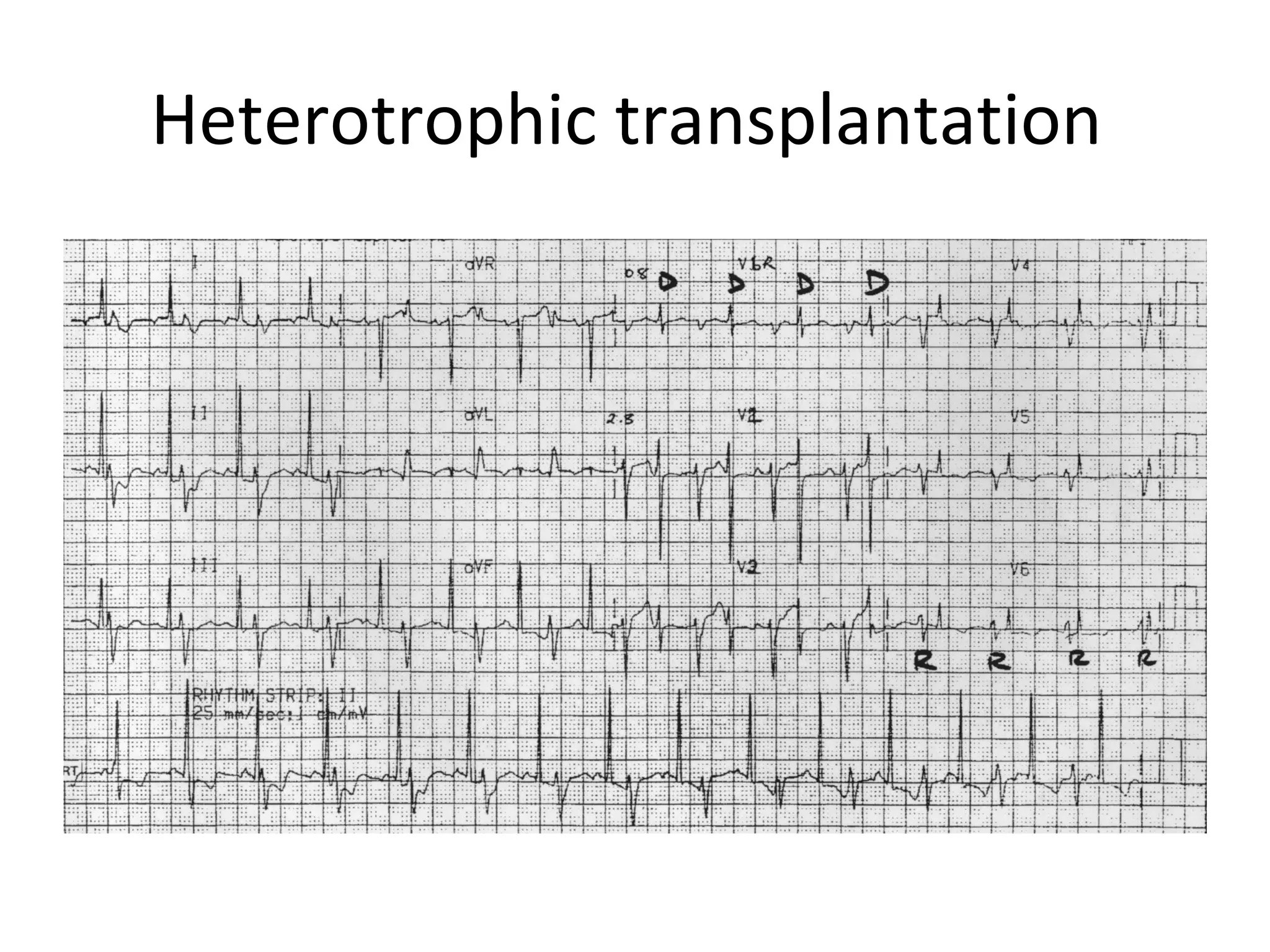 Heterotrophic transplantation
