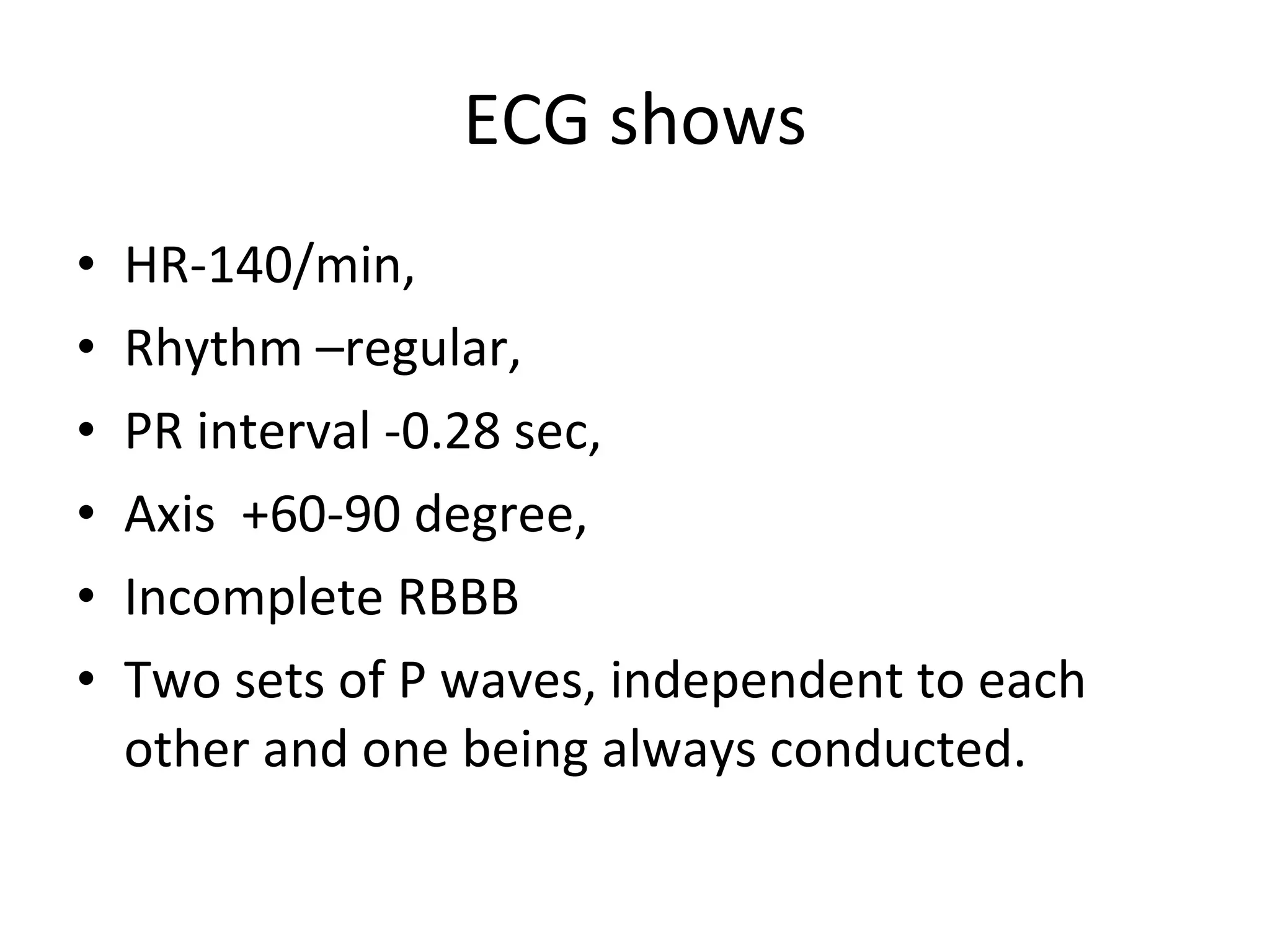 ECG shows HR-140/min, Rhythm –regular, PR interval -0.28 sec, Axis +60-90 degree, Incomplete RBBB Two sets of P waves, independent to each other and one being always conducted.