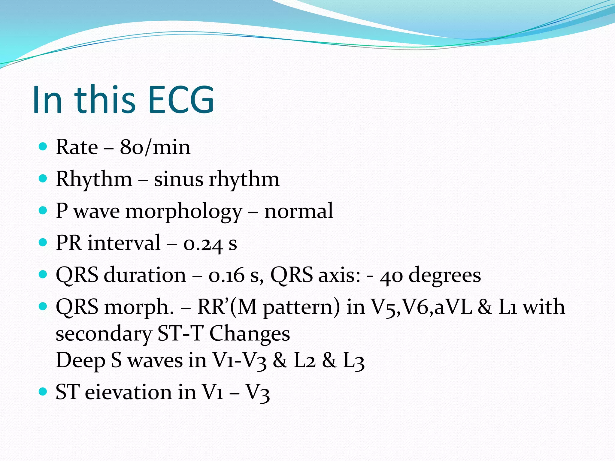 ECG: Trifascicular Block | PPTX