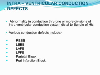 INTRA – VENTRICULAR CONDUCTION DEFECTS Abnormality in conduction thru one or more divisions of intra ventricular conduction system distal to Bundle of His