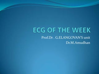 ECG OF THE WEEK Prof.Dr . G.ELANGOVAN’S unit Dr.M.Amudhan 
