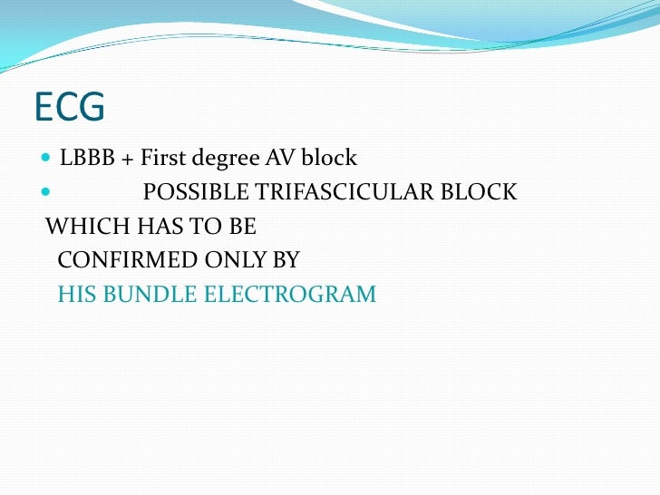 ECG Trifascicular Block