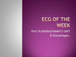 ECG OF THE WEEK Prof.VIJAYARAGHAVAN‘S UNIT B.Elavazhagan. 