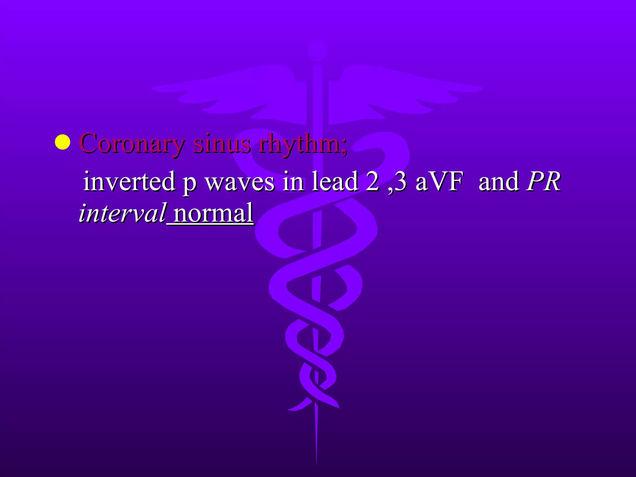 Coronary sinus rhythm; inverted p waves in lead 2 ,3 aVF and PR interval normal