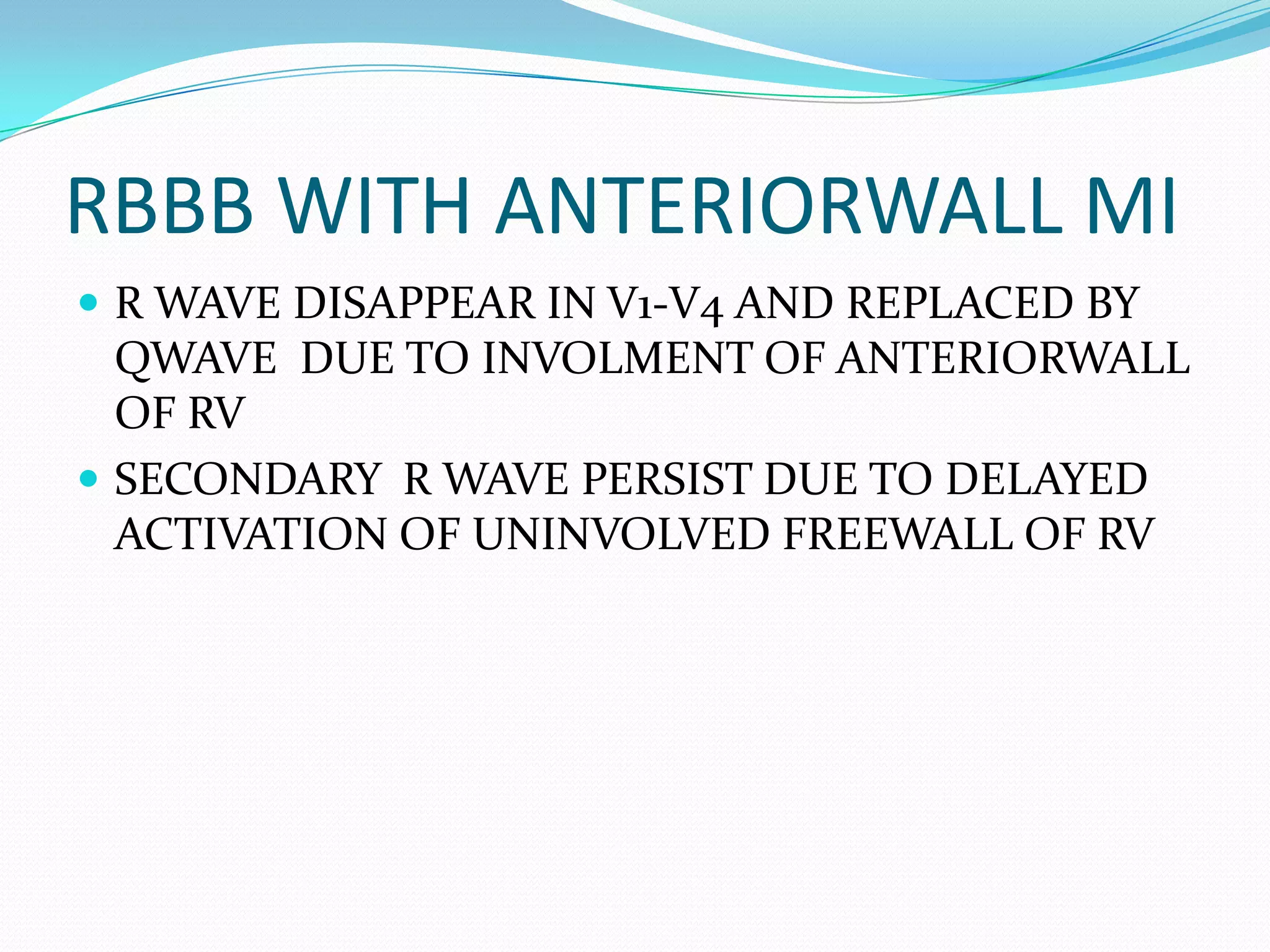 ECG: Bifascicular Block | PPTX