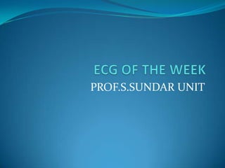 ECG OF THE WEEKPROF.S.SUNDAR UNIT