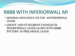 RBBB WITH INFERIORWALL MIMINIMAL INFLUENCE ON THE ANTERIORWALL LEADS QWAVE AND ST SEGMENT CHANGES IN INFERIORWALL LEADS ALONG WITH RBBB PATTERN IN PRECARDIAL LEADS