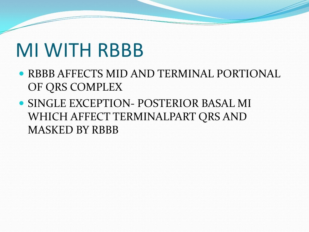 ECG Bifascicular Block