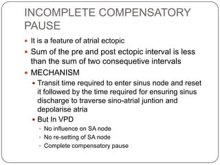 ECG: Atrial Bigeminy | PPT