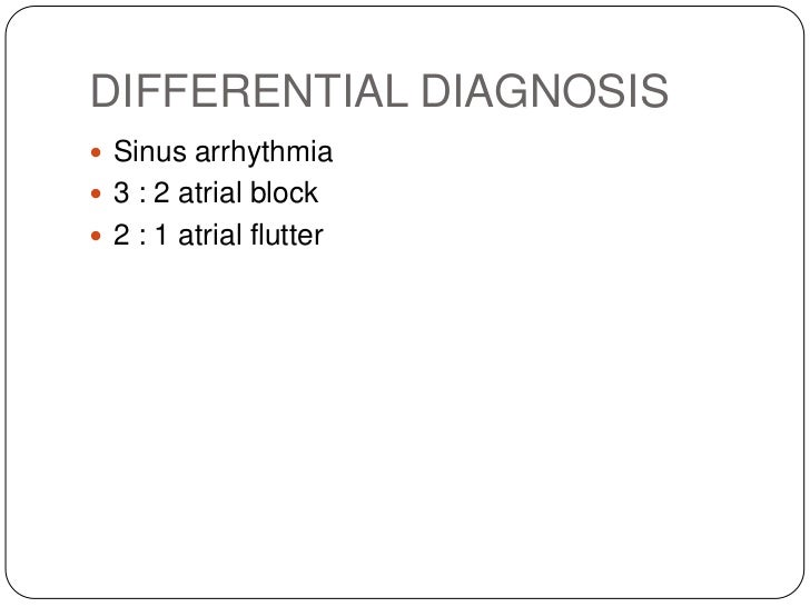 ECG: Atrial Bigeminy
