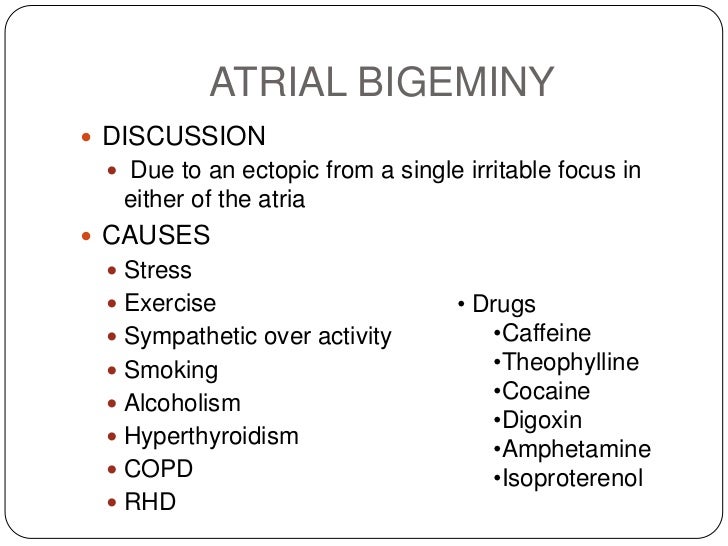 ECG: Atrial Bigeminy