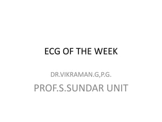 ECG OF THE WEEK DR.VIKRAMAN.G,P.G. PROF.S.SUNDAR UNIT 