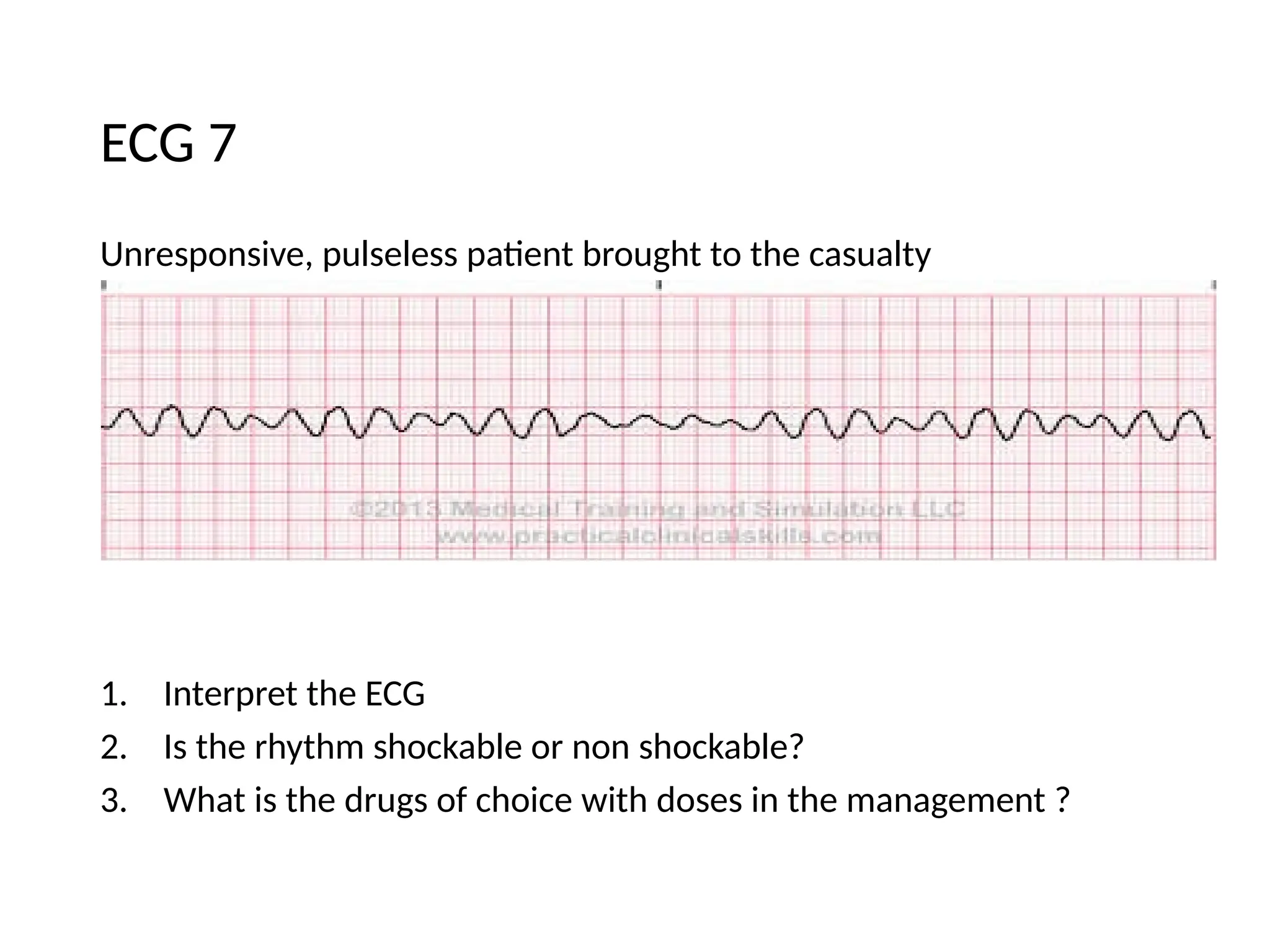 Unresponsive, pulseless patient brought to the casualty
1. Interpret the ECG
2. Is the rhythm shockable or non shockable?
3. What is the drugs of choice with doses in the management ?
ECG 7
 