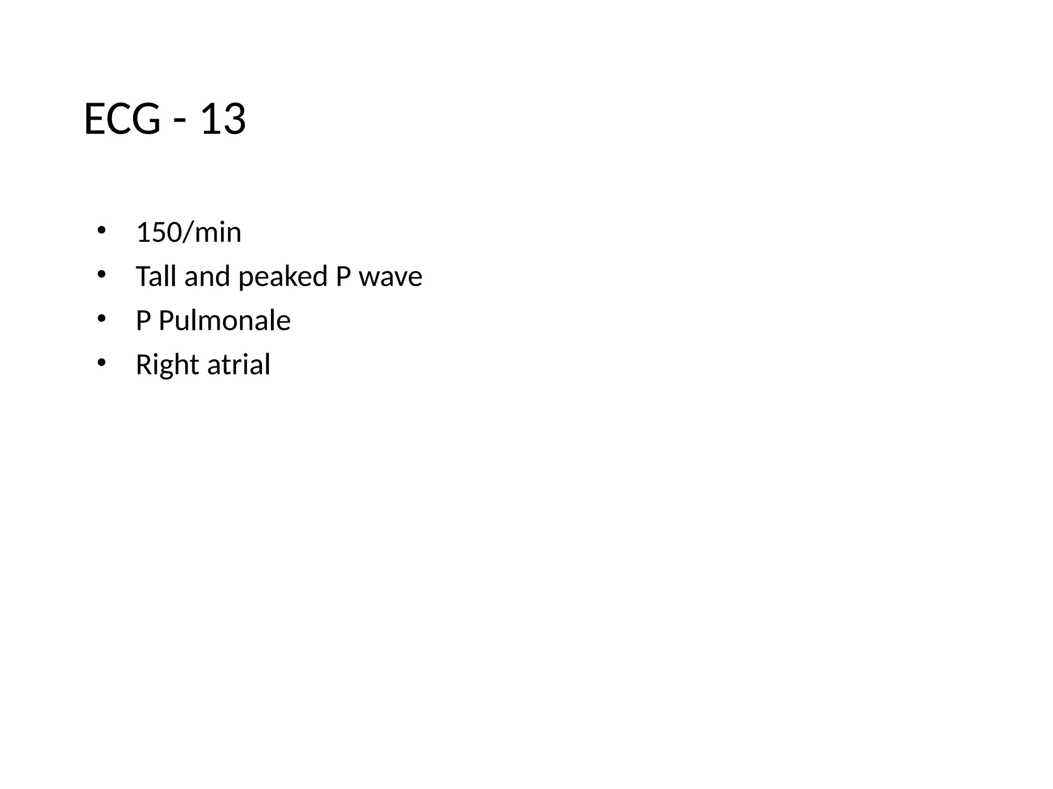 ECG - 13
• 150/min
• Tall and peaked P wave
• P Pulmonale
• Right atrial
 
