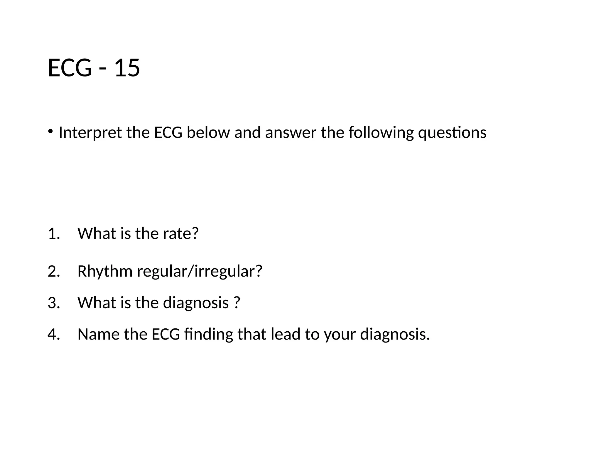 ECG - 15
• Interpret the ECG below and answer the following questions
1. What is the rate?
2. Rhythm regular/irregular?
3. What is the diagnosis ?
4. Name the ECG finding that lead to your diagnosis.
 