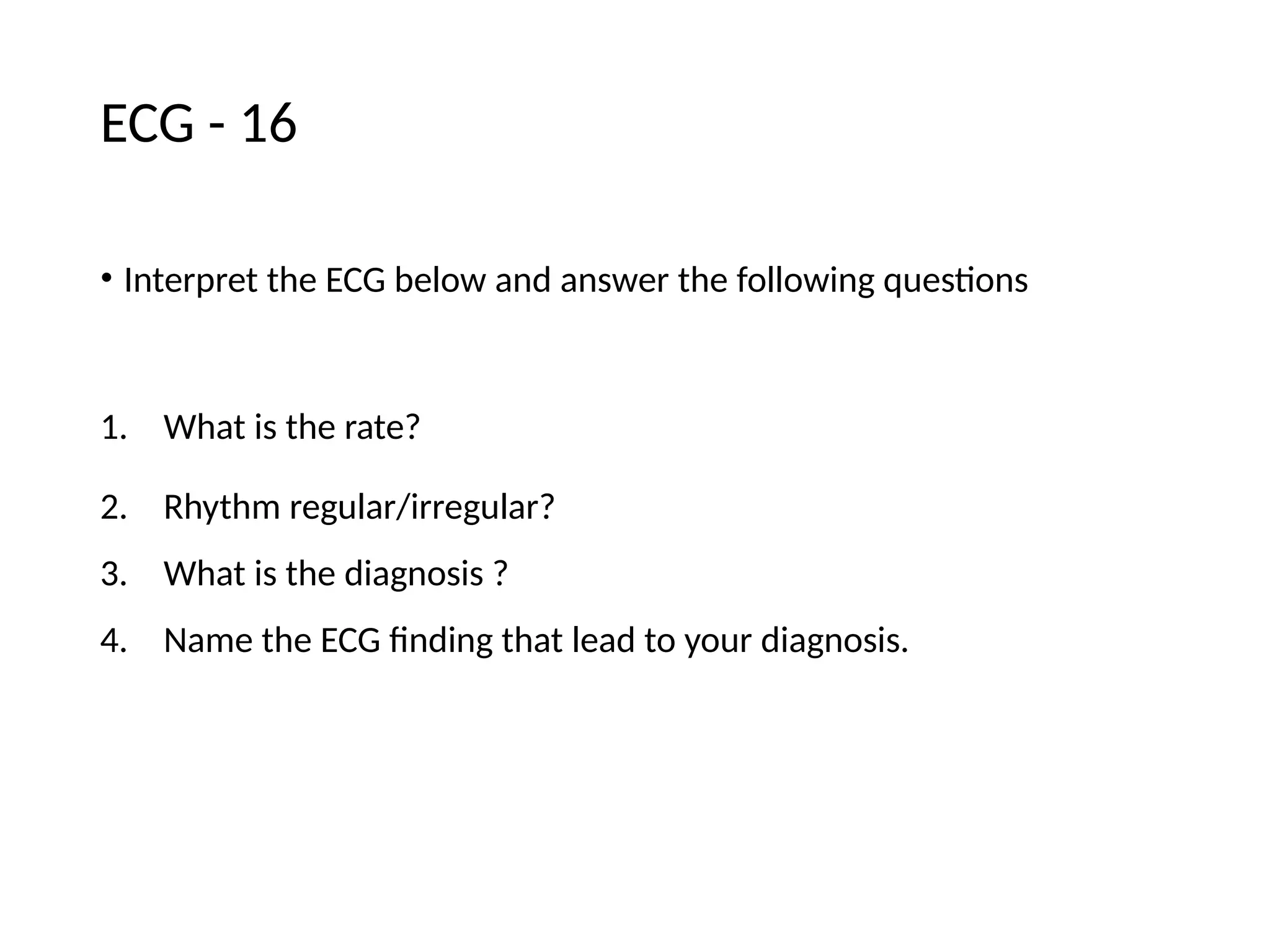 ECG - 16
• Interpret the ECG below and answer the following questions
1. What is the rate?
2. Rhythm regular/irregular?
3. What is the diagnosis ?
4. Name the ECG finding that lead to your diagnosis.
 