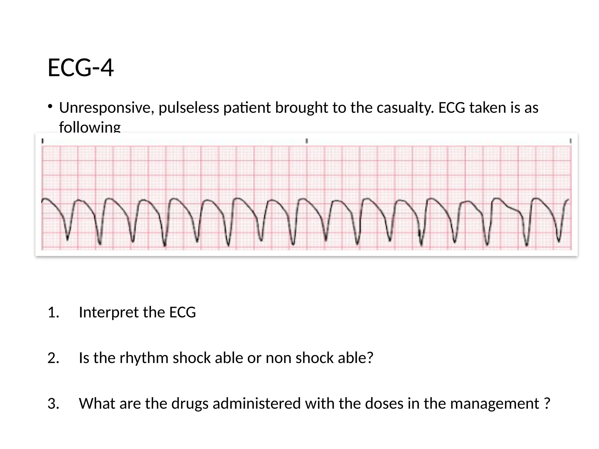 • Unresponsive, pulseless patient brought to the casualty. ECG taken is as
following
1. Interpret the ECG
2. Is the rhythm shock able or non shock able?
3. What are the drugs administered with the doses in the management ?
ECG-4
 