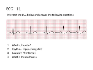 ECG OSCE.pptx from examination point of view | PPTX