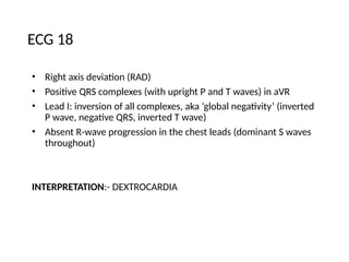 ECG OSCE.pptx from examination point of view | PPTX