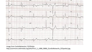 ECG Technical Overview | PDF