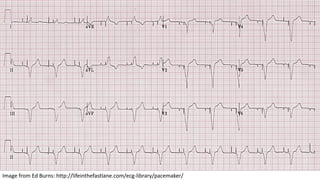 ECG Technical Overview | PDF