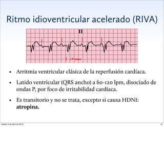 Ritmo Riva ElectrocardioGrama Para Apurados en un dia .pdf