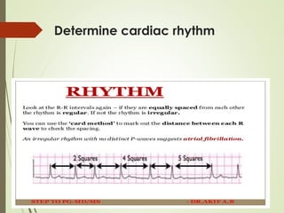 Recover Veterinary Rythym Chart ECG_Part-2__1_.ppt about ecg in veterinary animals | PPT