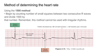 Comprehensive Introduction to Electrocardiogram (ECG) Fundamentals and ...