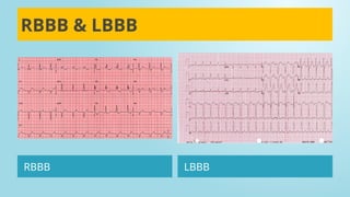 Comprehensive Guide to ECG Interpretation and Cardiac Conduction | PPTX