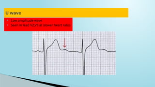 Comprehensive Guide to ECG Interpretation and Cardiac Conduction | PPTX