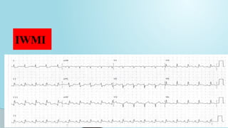 Comprehensive Guide to ECG Interpretation and Cardiac Conduction | PPTX