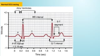 Comprehensive Guide to ECG Interpretation and Cardiac Conduction | PPTX