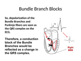 Therefore Blocks ECG basics only, reading ecg, abnormal ecgs, bundle blocks, arrhythmias ...