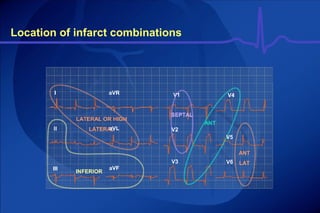 Ecg part introduction | PPT
